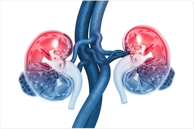 Acute Kidney Injury